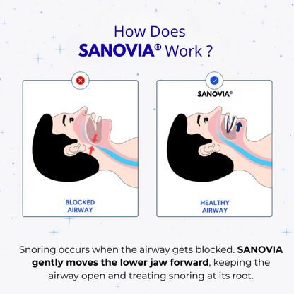 Anti-Snoring Mouthpiece Sanovia®